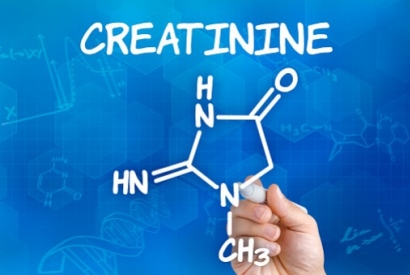 ¿Cuándo y cómo tomar creatina?